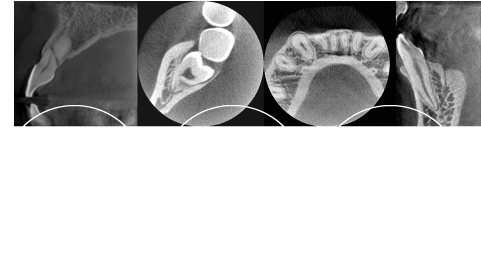 立体撮影・高精細画像・短時間撮影低被曝