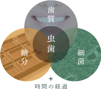 虫歯＝歯質+糖分+細菌+時間の経過