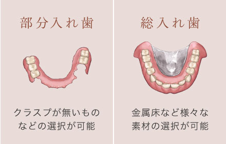 「部分入れ歯」クラスプが無いものなどの選択が可能　「総入れ歯」金属床など様々な素材の選択が可能