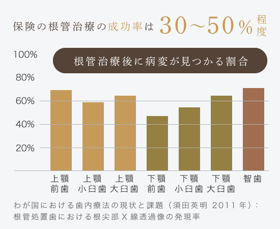 保険の根管治療の成功率は30%〜50%程度